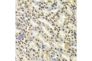 Immunohistochemistry (IHC) image for anti-Deoxycytidine Kinase (DCK) (AA 1-260) antibody (ABIN3022558) (DCK 抗体  (AA 1-260))