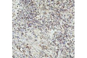 IHC analysis of G-CSF/CSF3 using anti-G-CSF/CSF3 antibody (ABIN3042762). (G-CSF 抗体  (AA 38-207))
