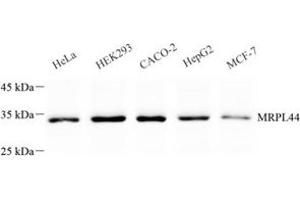 Western blot analysis of MRPL44 (ABIN7074647) at dilution of 1: 500 (MRPL44 抗体)