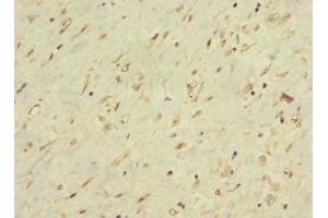 Immunohistochemistry of paraffin-embedded human smooth muscle tissue using ABIN7158484 at dilution of 1:100 (LONRF1 抗体  (AA 538-773))
