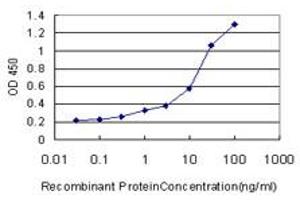 Detection limit for recombinant GST tagged AKR1C2 is approximately 0. (AKR1C2 抗体  (AA 224-323))