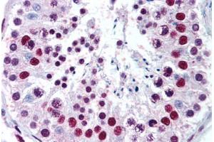 Testis (MECP2 抗体  (AA 11-25))