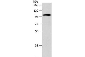 Western Blot analysis of 293T cell using ADCY1 Polyclonal Antibody at dilution of 1:1000 (ADCY1 抗体)