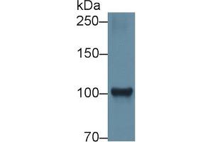 Detection of HK1 in Rat Cerebrum lysate using Polyclonal Antibody to Hexokinase 1 (HK1) (Hexokinase 1 抗体  (AA 413-540))