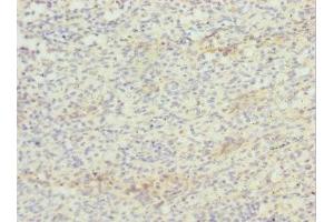Immunohistochemistry of paraffin-embedded human spleen tissue using ABIN7171725 at dilution of 1:100 (ZBTB48 抗体  (AA 1-280))