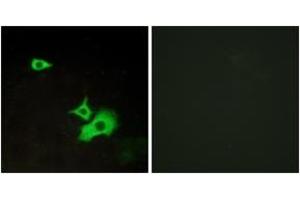Immunofluorescence analysis of LOVO cells, using ETBR2 Antibody.