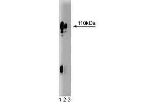 Western blot analysis of Lamp-1 on HepG2 cell lysate. (LAMP1 抗体  (AA 25-224))