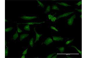 Immunofluorescence of purified MaxPab antibody to PSME3 on HeLa cell. (PSME3 抗体  (AA 1-254))