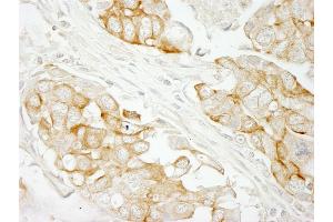 Immunohistochemistry (IHC) image for anti-Notch 2 (NOTCH2) (AA 2421-2471) antibody (ABIN7448697)