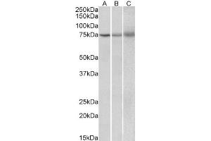 ABIN2563581 (2µg/ml) staining of Human (A), Mouse (B) and Rat (C) Spleen lysate (35µg protein in RIPA buffer). (KLHL6 抗体  (Internal Region))