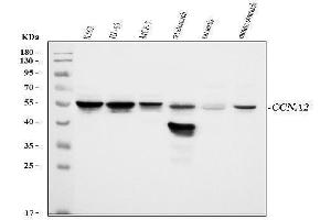 Western blot analysis of Cyclin A2 using anti-Cyclin A2 antibody (ABIN3043481).
