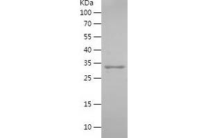 Uroplakin 2 Protein (UPK2) (AA 85-184) (His-IF2DI Tag)
