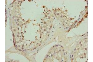 Immunohistochemistry of paraffin-embedded human testis tissue using ABIN7162475 at dilution of 1:100 (TRIP13 抗体  (AA 181-390))