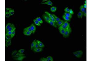 Immunofluorescence staining of HepG2 cells with ABIN7170156 at 1:100, counter-stained with DAPI. (SLC22A25 抗体  (AA 31-145))