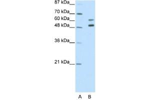 Western Blot showing ZNF682 antibody used at a concentration of 1-2 ug/ml to detect its target protein. (ZNF682 抗体  (N-Term))