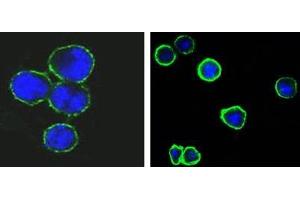 Confocal immunofluorescence analysis of methanol-fixed BCBL-1 (left) and L1210 (right) cells using CD37 antibody (green), showing membrane localization. (CD37 抗体)