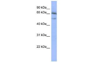 WB Suggested Anti-NFKBIE Antibody Titration:  0. (NFKBIE 抗体  (Middle Region))