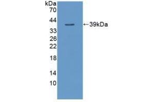 Detection of Recombinant TNFaIP3, Human using Polyclonal Antibody to Tumor Necrosis Factor Alpha Induced Protein 3 (TNFaIP3) (TNFAIP3 抗体  (AA 1-300))