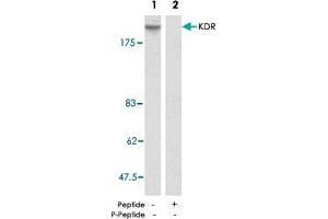 Western blot analysis of extract from SK-OV-3 cells using KDR polyclonal antibody  . (VEGFR2/CD309 抗体)