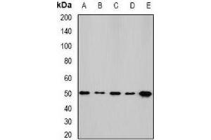 Western blot analysis of NFS1 expression in HepG2 (A), SKOV3 (B), mouse kidney (C), mouse heart (D), rat liver (E) whole cell lysates. (NFS1 抗体)