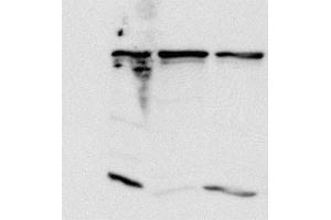 Hela lysates were incubated with Anti-MAD1L1 (clone 9B10) and the immunecomplex precipitated with protein G coupled beads. (PSMD14 抗体)