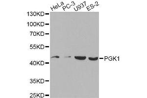 Western blot analysis of extracts of various cell lines, using PGK1 antibody. (PGK1 抗体  (AA 1-417))