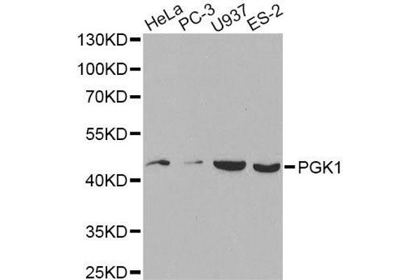 PGK1 anticorps  (AA 1-417)