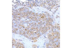 Immunohistochemistry (IHC) image for anti-Melanoma Antigen Family D, 1 (MAGED1) (AA 635-834) antibody (ABIN3021415)