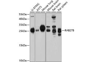Western blot analysis of extracts of various cell lines, using RB antibody (ABIN6132610, ABIN6146565, ABIN6146566 and ABIN6214629) at 1:1000 dilution. (RAB27B 抗体  (AA 1-218))