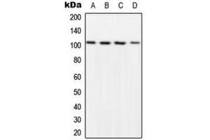 Western blot analysis of NF-kappaB p105 (pS932) expression in HeLa LPS-treated (A), NIH3T3 LPS-treated (B), Raw264. (NFKB1 抗体  (C-Term, pSer932))