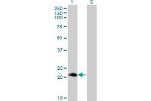 Western Blot analysis of PLA2G12A expression in transfected 293T cell line by PLA2G12A monoclonal antibody (M01), clone 1D11. (PLA2G12A 抗体  (AA 90-188))