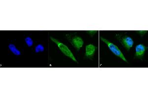 Immunocytochemistry/Immunofluorescence analysis using Rabbit Anti-GRP78 Polyclonal Antibody (ABIN361824 and ABIN361825). (GRP78 抗体)