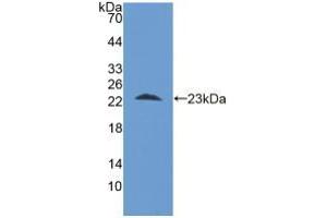 Western blot analysis of recombinant Human STIP1. (STIP1 抗体  (AA 1-169))