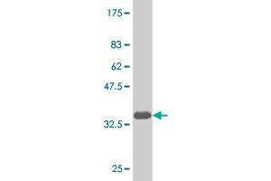 Western Blot detection against Immunogen (35. (NKX6-1 抗体  (AA 191-275))