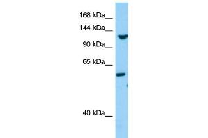 WB Suggested Anti-TLL1 Antibody Titration: 1. (TLL1 抗体  (C-Term))