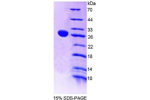 SDS-PAGE analysis of Human NT5C2 Protein. (NT5C2 蛋白)