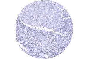 Lymph node with weak to moderate TLE1 staining in a subset of lymphocytes predominantly in germinal centres