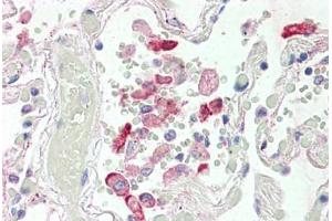 Human Lung (formalin-fixed, paraffin-embedded) stained with CES1 antibody ABIN337128 at 2. (CES1 抗体  (AA 533-544))
