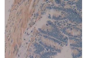 IHC-P analysis of Rat Intestine Tissue, with DAB staining. (MAP1A 抗体  (AA 2110-2367))