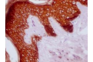 IHC image of ABIN7180977 diluted at 1:100 and staining in paraffin-embedded human skin tissue performed on a Leica BondTM system. (KRT14/KRT16/KRT5/KRT6A/KRT8 抗体)