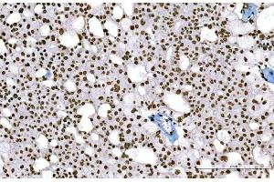 IHC analysis of Histone H1.