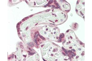 Formalin-fixed and paraffin-embedded H. (HERV (ERVWE1) (AA 400-429) 抗体)