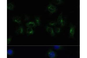 Immunofluorescence analysis of HeLa cells using CLTB Polyclonal Antibody at dilution of 1:100 (40x lens). (CLTB 抗体)