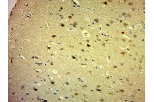 Paraformaldehyde-fixed, paraffin embedded rat brain, Antigen retrieval by boiling in sodium citrate buffer (pH6. (PARP16 抗体  (AA 120-170))