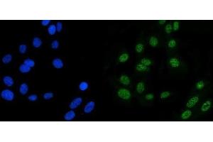 IF analysis of MSH6 using anti-MSH6 antibody (ABIN7601449). (MSH6 抗体  (AA 357-388))