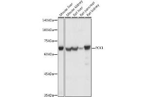 Western blot analysis of extracts of various cell lines, using PCK1 antibody (ABIN3022753, ABIN3022754, ABIN3022755 and ABIN6219210) at 1:1000 dilution. (PCK1 抗体  (C-Term))