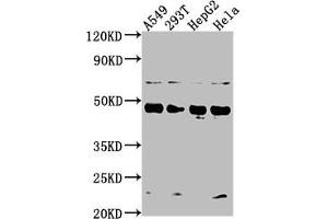 Western Blot Positive WB detected in: A549 whole cell lysate, 293T whole cell lysate, HepG2 whole cell lysate, Hela whole cell lysate All lanes: SNX5 antibody at 1:2000 Secondary Goat polyclonal to rabbit IgG at 1/50000 dilution Predicted band size: 47, 14 kDa Observed band size: 47 kDa (SNX5 抗体  (AA 7-245))