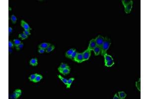 Immunofluorescent analysis of HepG2 cells using ABIN7144390 at dilution of 1:100 and Alexa Fluor 488-congugated AffiniPure Goat Anti-Rabbit IgG(H+L) (AAK1 抗体  (AA 274-465))