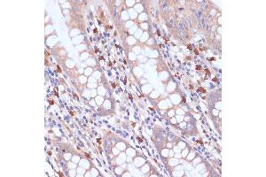Immunohistochemistry of paraffin-embedded human colon using PI3 Kinase p85 beta antibody (ABIN7269320) at dilution of 1:200 (40x lens). (PIK3R2 抗体)