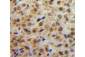Used in DAB staining on fromalin fixed paraffin-embedded Ovary tissue (ESR2 抗体  (AA 149-213))